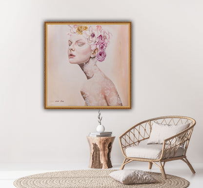 Albino with a crown of flowers